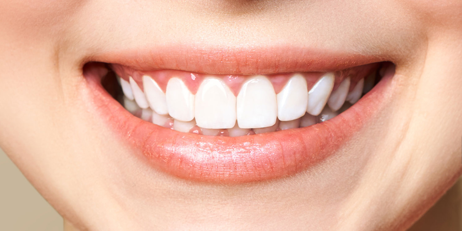 白い美しい歯を手に入れる審美治療